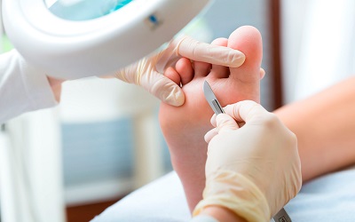 corte y exfoliacion de uñas